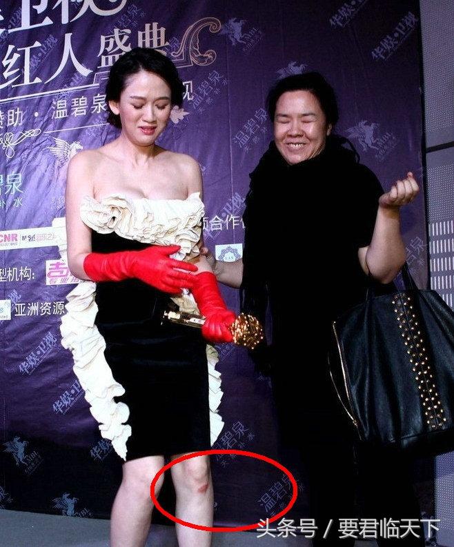 养老院预防老年跌倒视频的重要性及其影响